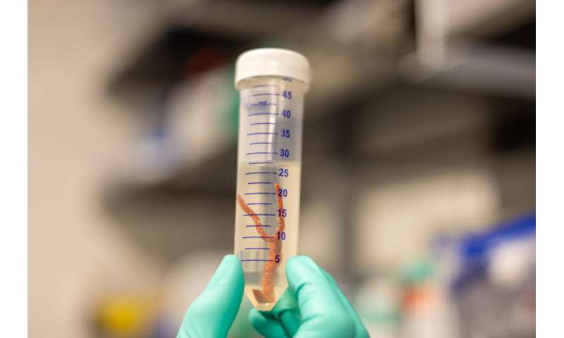 From soft to solid: How a coral stiffens its skeleton on demand